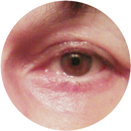 10 Tips - How To Remove Dark Circles Under The Eyes